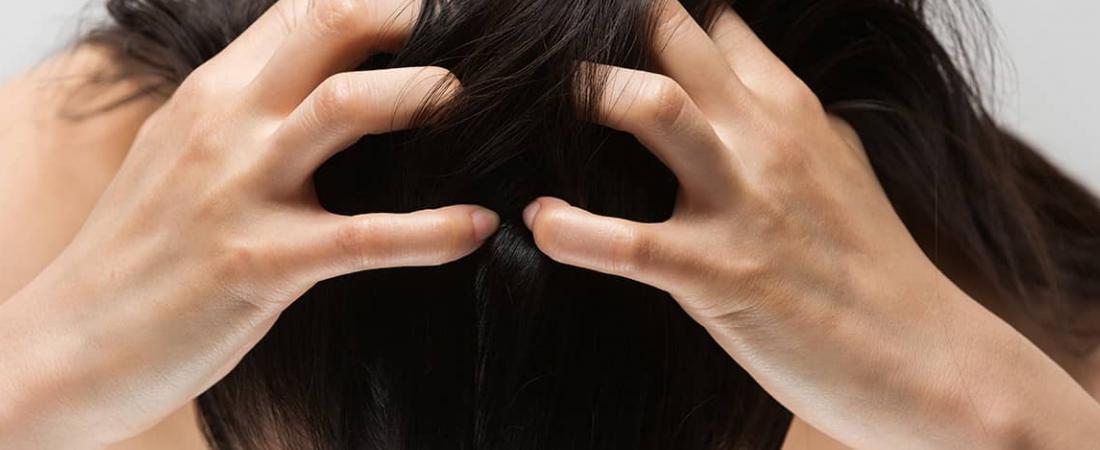 Irritation du cuir chevelu : causes et traitements
